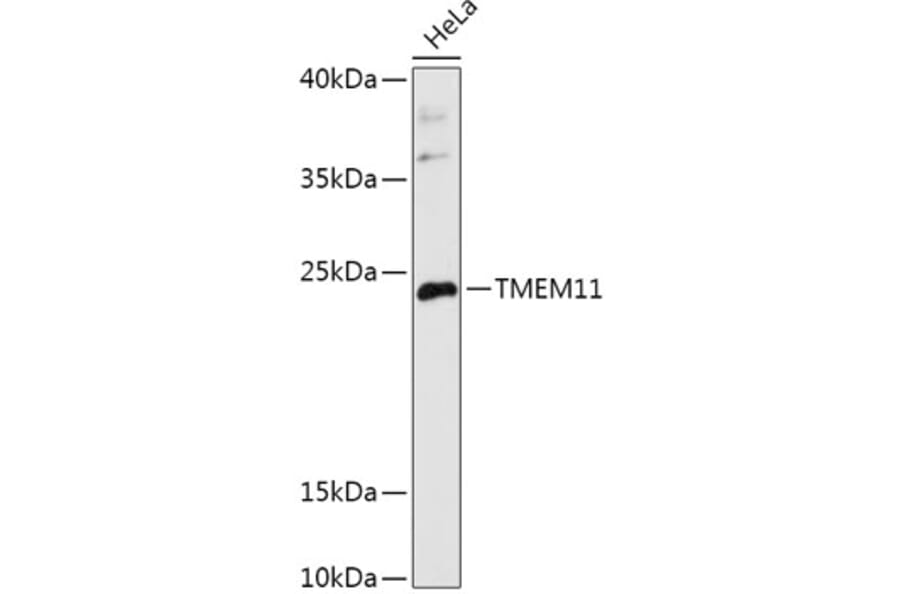 Western Blot - Anti-PM1 Antibody (A306830) - Antibodies.com
