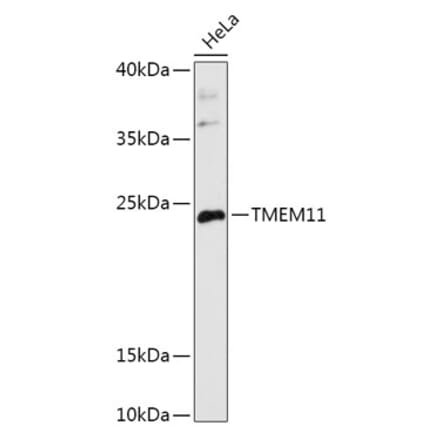 Western Blot - Anti-PM1 Antibody (A306830) - Antibodies.com