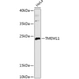 Western Blot - Anti-PM1 Antibody (A306830) - Antibodies.com