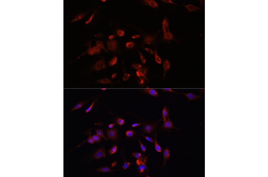 Immunofluorescence - Anti-PM1 Antibody (A306830) - Antibodies.com