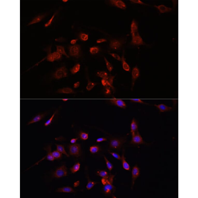 Immunofluorescence - Anti-PM1 Antibody (A306830) - Antibodies.com