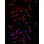 Immunofluorescence - Anti-PM1 Antibody (A306830) - Antibodies.com