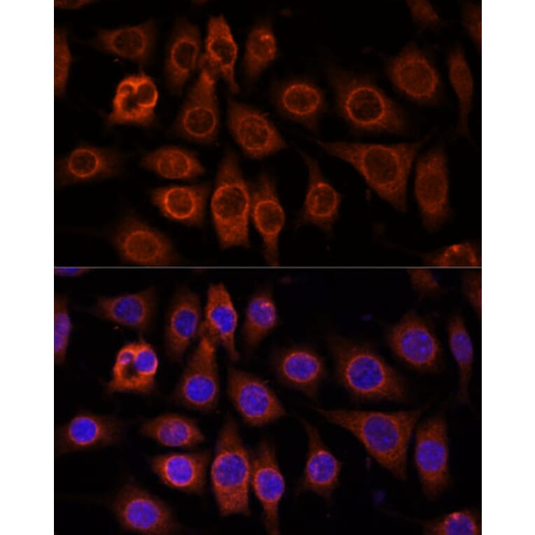 Immunofluorescence - Anti-PM1 Antibody (A306830) - Antibodies.com