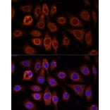 Immunofluorescence - Anti-PM1 Antibody (A306830) - Antibodies.com