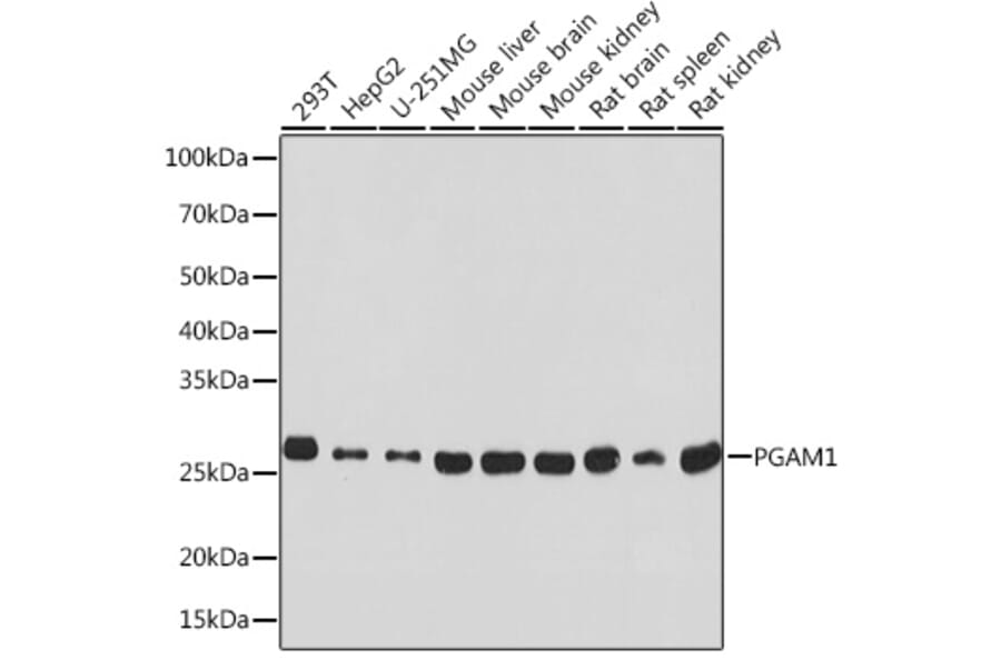 Western Blot - Anti-PGAM1 Antibody [ARC0913] (A306831) - Antibodies.com