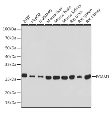 Western Blot - Anti-PGAM1 Antibody [ARC0913] (A306831) - Antibodies.com