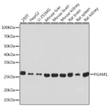 Western Blot - Anti-PGAM1 Antibody [ARC0913] (A306831) - Antibodies.com