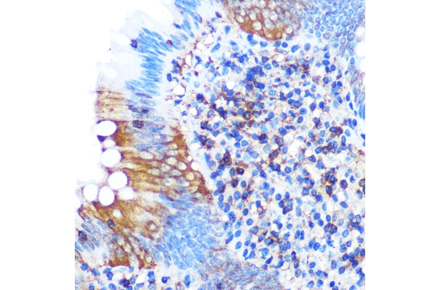 Immunohistochemistry - Anti-PGAM1 Antibody [ARC0913] (A306831) - Antibodies.com
