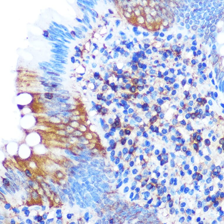 Immunohistochemistry - Anti-PGAM1 Antibody [ARC0913] (A306831) - Antibodies.com
