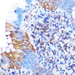 Immunohistochemistry - Anti-PGAM1 Antibody [ARC0913] (A306831) - Antibodies.com