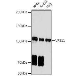 Western Blot - Anti-VPS11 Antibody [ARC2325] (A306832) - Antibodies.com