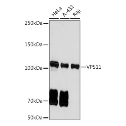 Western Blot - Anti-VPS11 Antibody [ARC2325] (A306832) - Antibodies.com