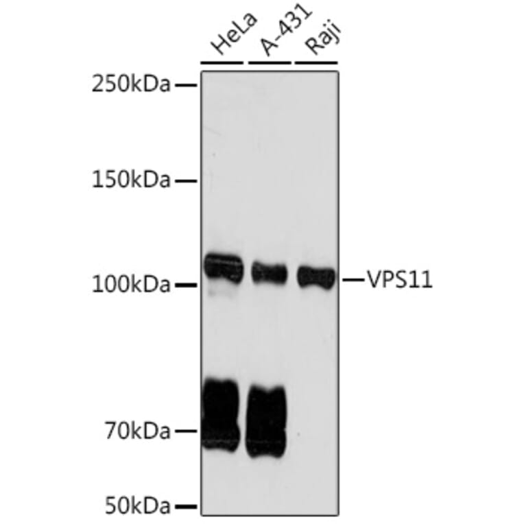 Western Blot - Anti-VPS11 Antibody [ARC2325] (A306832) - Antibodies.com