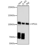 Western Blot - Anti-VPS11 Antibody [ARC2325] (A306832) - Antibodies.com