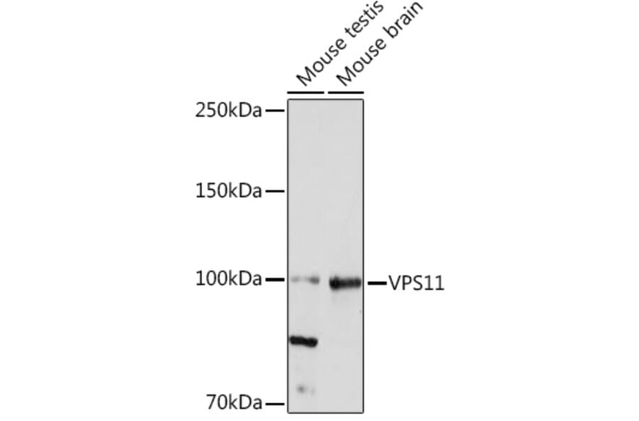 Western Blot - Anti-VPS11 Antibody [ARC2325] (A306832) - Antibodies.com