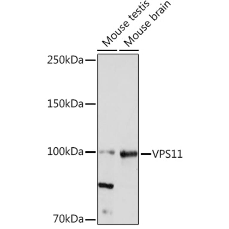 Western Blot - Anti-VPS11 Antibody [ARC2325] (A306832) - Antibodies.com