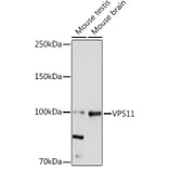 Western Blot - Anti-VPS11 Antibody [ARC2325] (A306832) - Antibodies.com