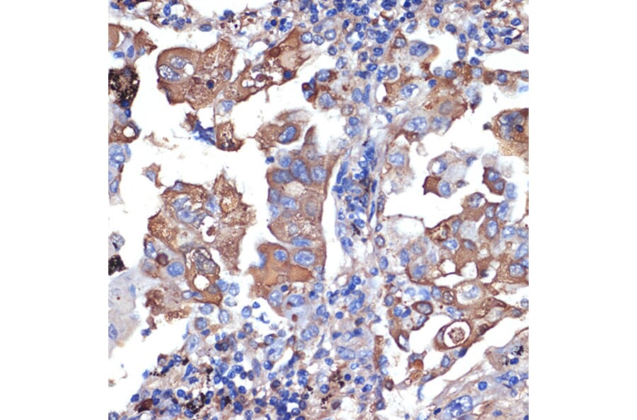 Immunohistochemistry - Anti-VPS11 Antibody [ARC2325] (A306832) - Antibodies.com