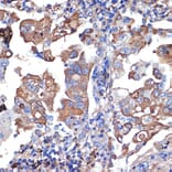 Immunohistochemistry - Anti-VPS11 Antibody [ARC2325] (A306832) - Antibodies.com