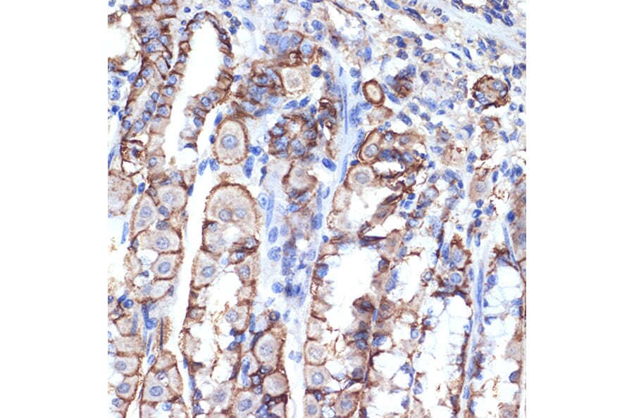 Immunohistochemistry - Anti-VPS11 Antibody [ARC2325] (A306832) - Antibodies.com