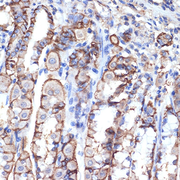 Immunohistochemistry - Anti-VPS11 Antibody [ARC2325] (A306832) - Antibodies.com