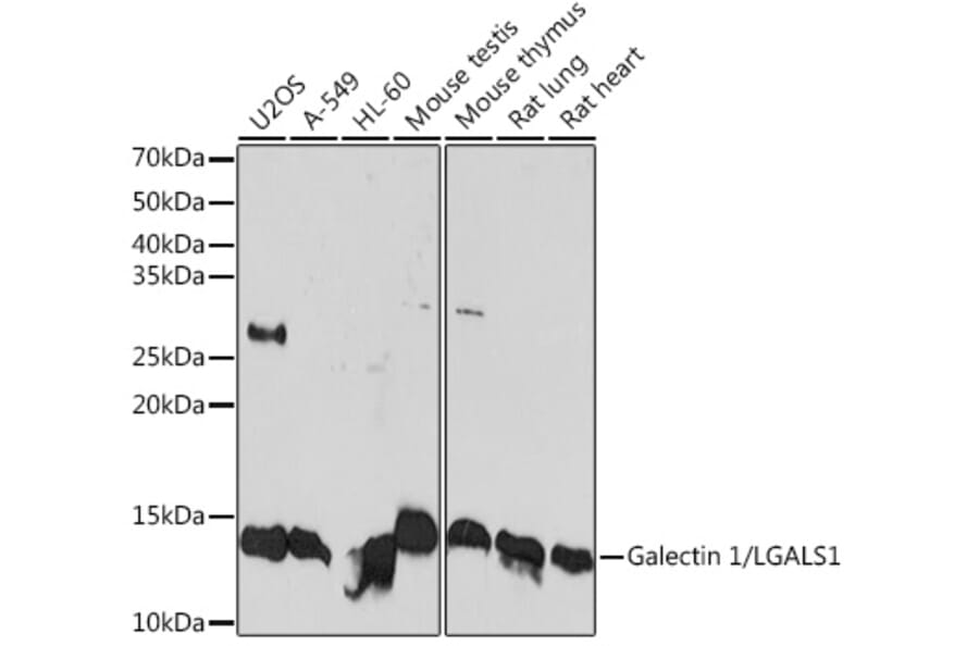 Western Blot - Anti-Galectin 1 Antibody [ARC1110] (A306834) - Antibodies.com