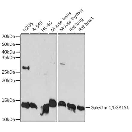 Western Blot - Anti-Galectin 1 Antibody [ARC1110] (A306834) - Antibodies.com