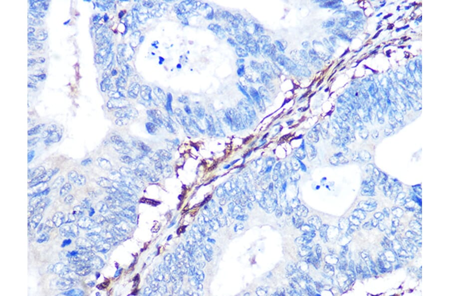 Immunohistochemistry - Anti-Galectin 1 Antibody [ARC1110] (A306834) - Antibodies.com