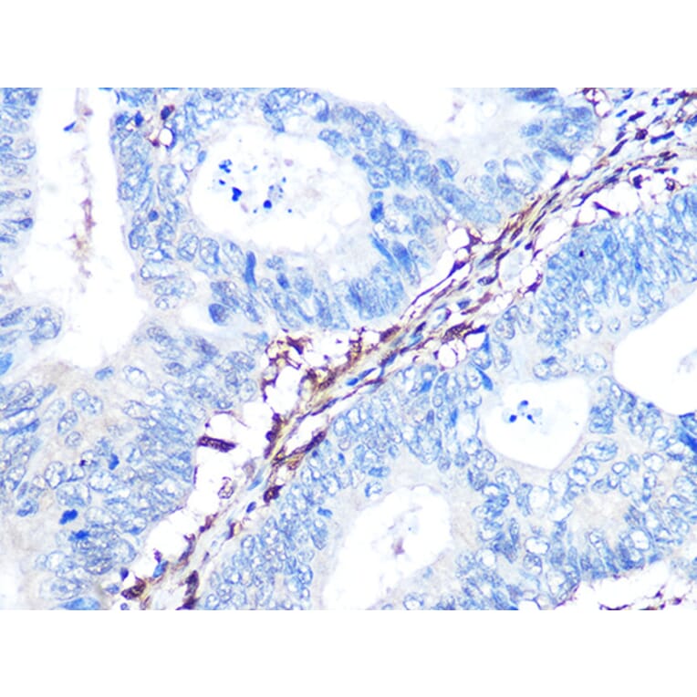 Immunohistochemistry - Anti-Galectin 1 Antibody [ARC1110] (A306834) - Antibodies.com