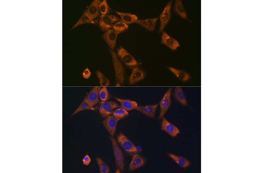 Immunofluorescence - Anti-Galectin 1 Antibody [ARC1110] (A306834) - Antibodies.com