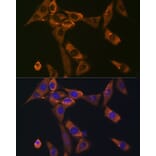 Immunofluorescence - Anti-Galectin 1 Antibody [ARC1110] (A306834) - Antibodies.com