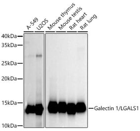 Western Blot - Anti-Galectin 1 Antibody [ARC53156] (A306835) - Antibodies.com