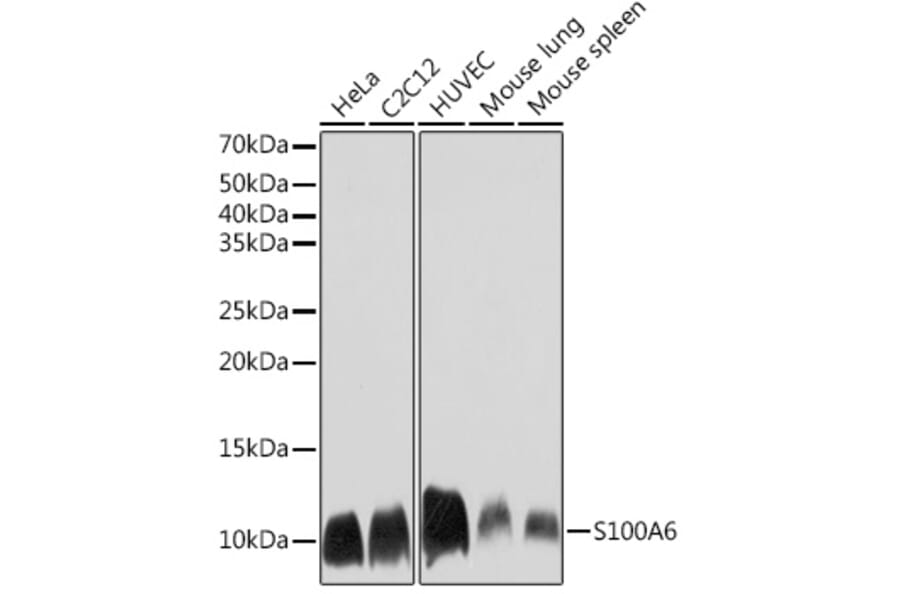 Western Blot - Anti-S100 alpha 6/PRA Antibody [ARC2005] (A306836) - Antibodies.com