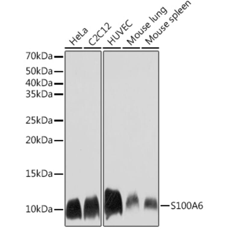 Western Blot - Anti-S100 alpha 6/PRA Antibody [ARC2005] (A306836) - Antibodies.com