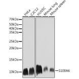 Western Blot - Anti-S100 alpha 6/PRA Antibody [ARC2005] (A306836) - Antibodies.com
