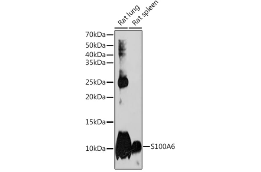 Western Blot - Anti-S100 alpha 6/PRA Antibody [ARC2005] (A306836) - Antibodies.com