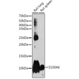 Western Blot - Anti-S100 alpha 6/PRA Antibody [ARC2005] (A306836) - Antibodies.com