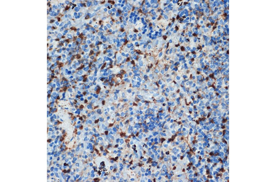Immunohistochemistry - Anti-S100 alpha 6/PRA Antibody [ARC2005] (A306836) - Antibodies.com