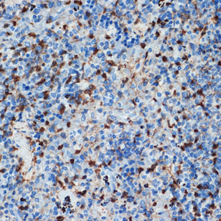 Immunohistochemistry - Anti-S100 alpha 6/PRA Antibody [ARC2005] (A306836) - Antibodies.com