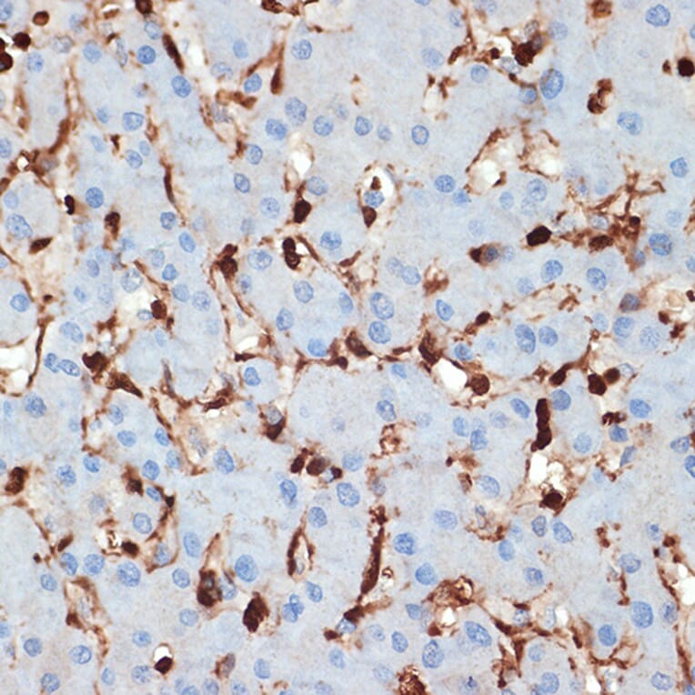 Immunohistochemistry - Anti-S100 alpha 6/PRA Antibody [ARC2005] (A306836) - Antibodies.com