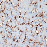 Immunohistochemistry - Anti-S100 alpha 6/PRA Antibody [ARC2005] (A306836) - Antibodies.com
