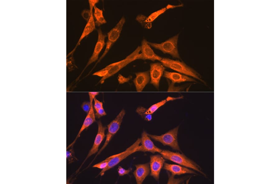 Immunofluorescence - Anti-S100 alpha 6/PRA Antibody [ARC2005] (A306836) - Antibodies.com