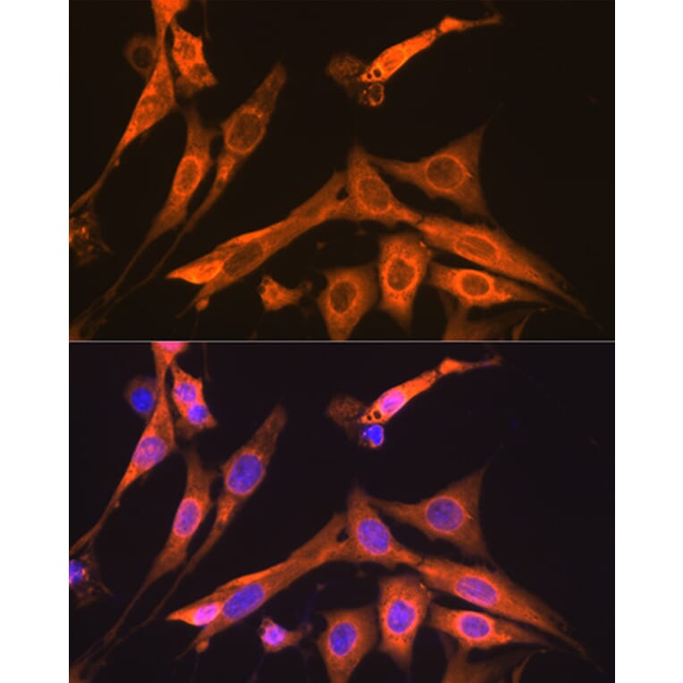 Immunofluorescence - Anti-S100 alpha 6/PRA Antibody [ARC2005] (A306836) - Antibodies.com