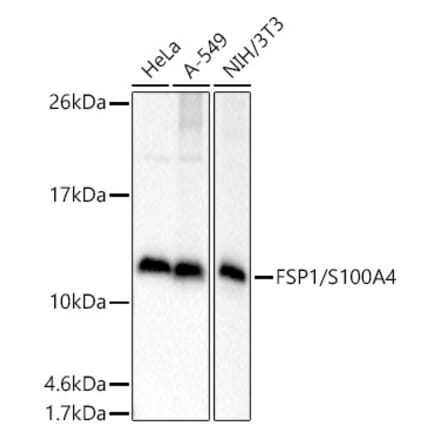 Western Blot - Anti-S100A4 Antibody (A306837) - Antibodies.com
