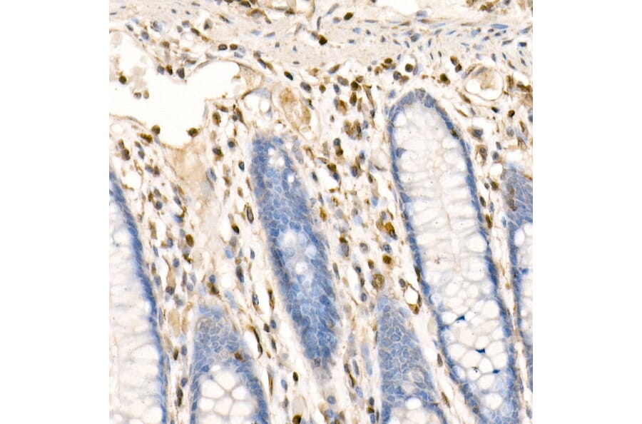 Immunohistochemistry - Anti-S100A4 Antibody (A306837) - Antibodies.com