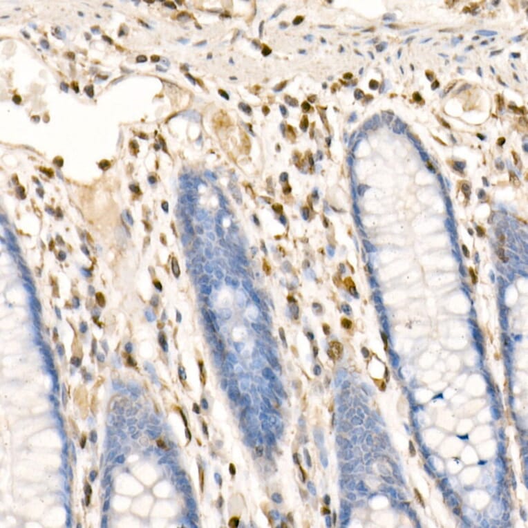 Immunohistochemistry - Anti-S100A4 Antibody (A306837) - Antibodies.com