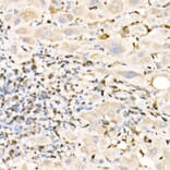 Immunohistochemistry - Anti-S100A4 Antibody (A306837) - Antibodies.com