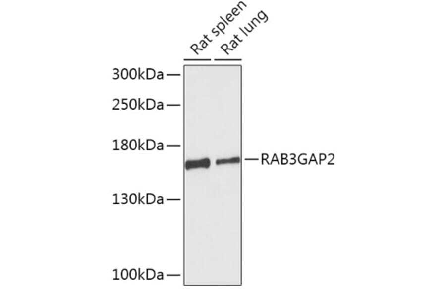 Western Blot - Anti-RAB3GAP2 Antibody (A306838) - Antibodies.com