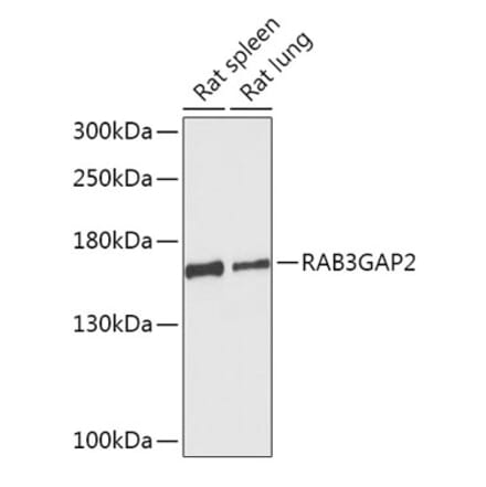 Western Blot - Anti-RAB3GAP2 Antibody (A306838) - Antibodies.com