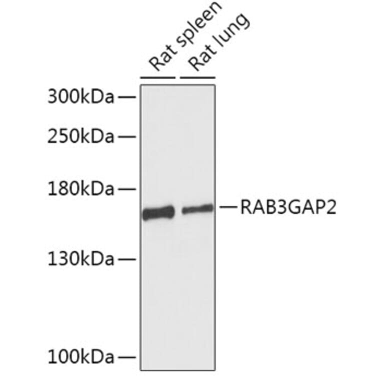 Western Blot - Anti-RAB3GAP2 Antibody (A306838) - Antibodies.com